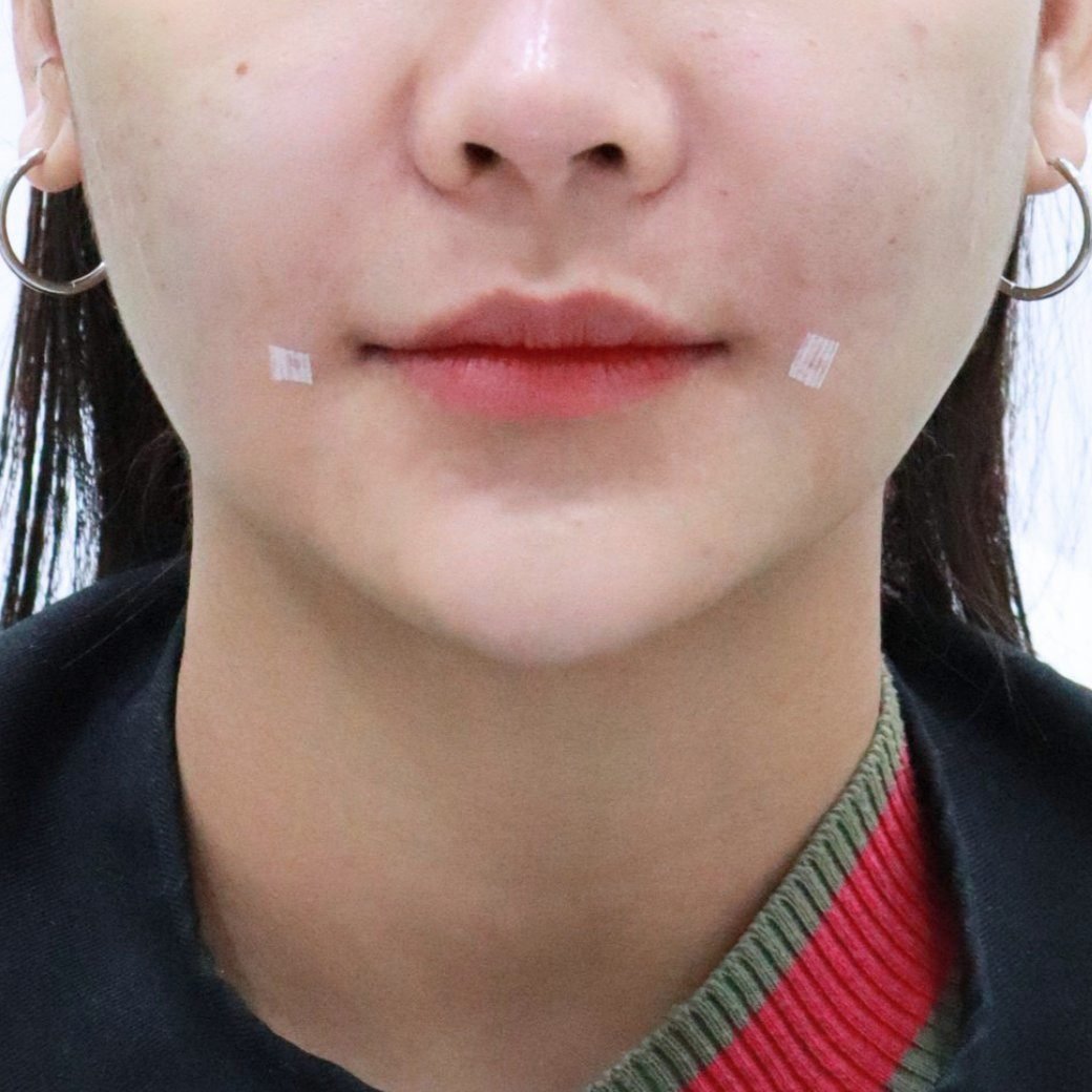 After