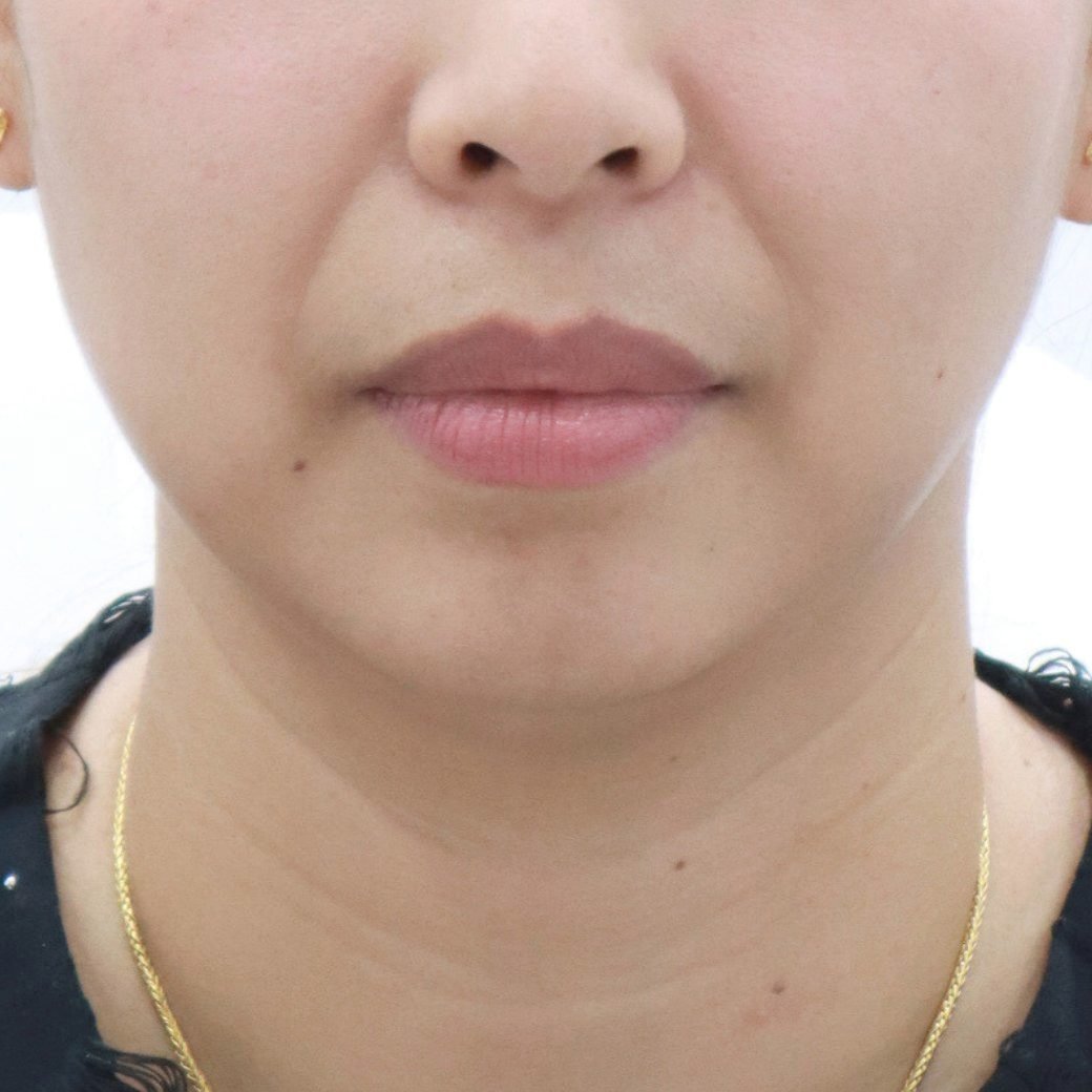 Before