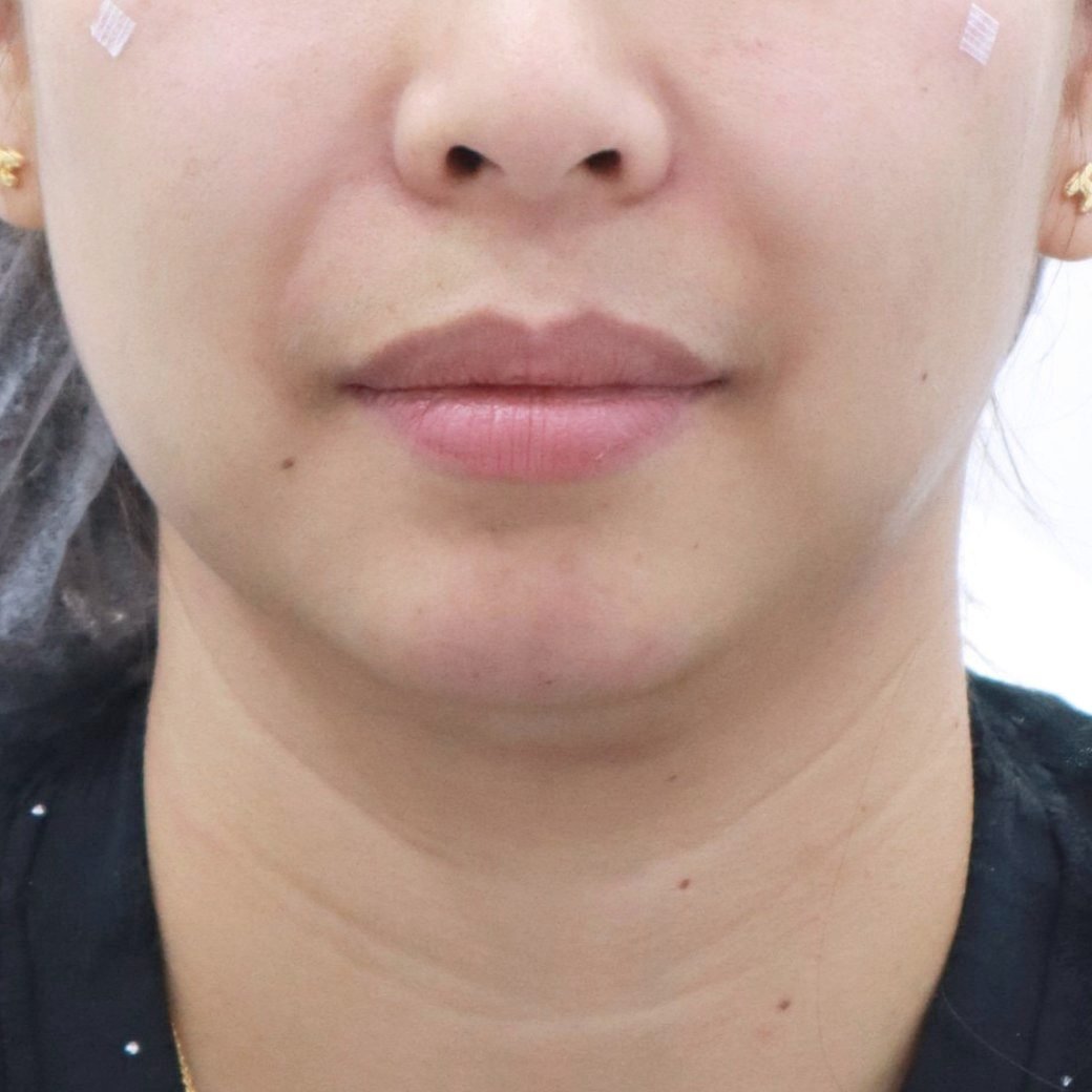 After