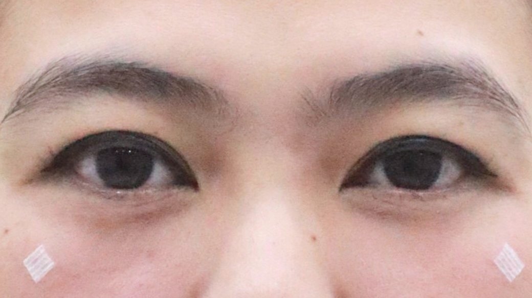 After
