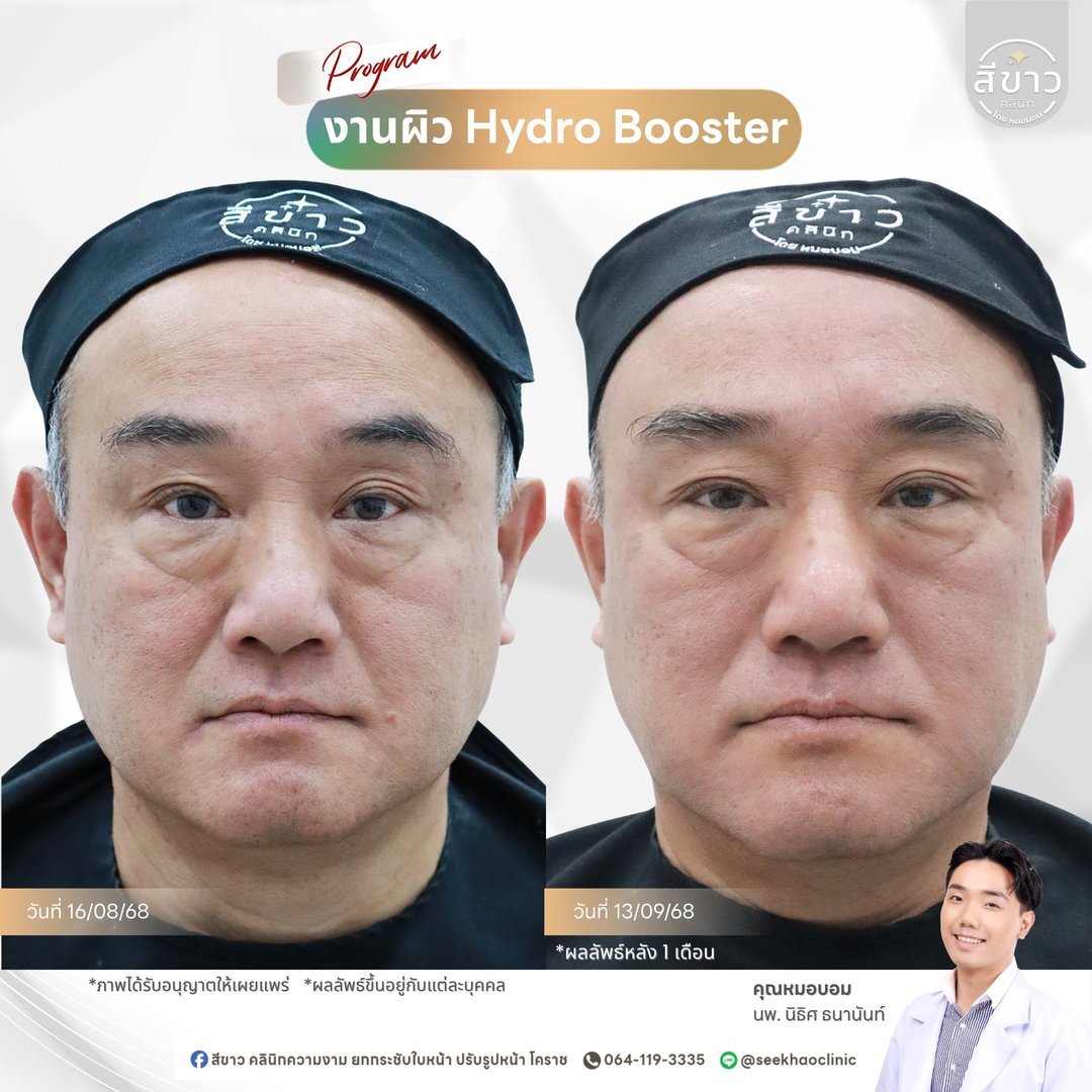 งานผิว Hydro Booster