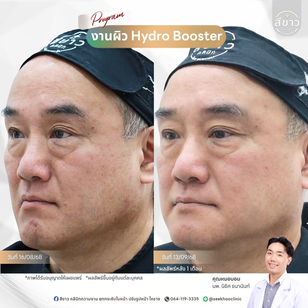 งานผิว Hydro Booster
